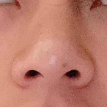 Taehyung Reference Photos, Taehyung Nose, Honey Skin, Apa Aja, Reference Photos, Art Reference Photos, Kim Taehyung, Art Reference, Nose Ring