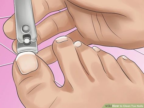 How to Clean Toe Nails: 11 Steps (with Pictures) - wikiHow Clean Toe Nails, Clean Toenails, French Tip Toes, Out Of Mind, Nail Drawing, Pedicure At Home, Cute Toe Nails, Diy Facial, Ingrown Toe Nail