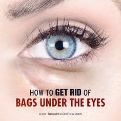 Undereye Bags Remedy, Eye Bag Remedies, Puffy Eyes Remedy, Baggy Eyes, Eye Roller, Eyes Beautiful, Under Eye Puffiness, Remove Dark Circles, Healthy Advice