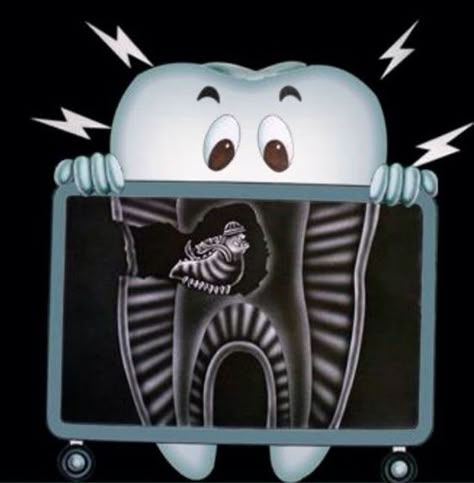 Dentaltown - Can you diagnose this X-Ray? What do you see? Tooth Art, Dental Wallpaper, Dental Images, Dental Posts, Dental Posters, Dental Jokes, Kedokteran Gigi, Dental Implants Cost, Dental Hygiene School