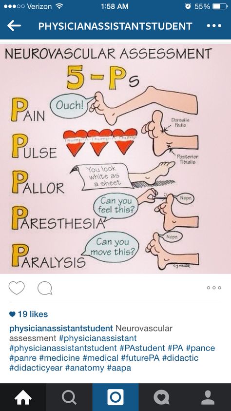Neurovascular assessment Neurovascular Assessment, Nursing Neuro, Nursing Student Organization, Nursing Clinicals, Physician Assistant Student, Nclex Review, School Info, Medical Knowledge, Nclex