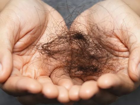 Hair Growth Foods, Androgenetic Alopecia, Bald Patches, Hair Issues, Regrow Hair, Homemade Hair Products, Hair Control, Lost Hair, Skin Discoloration