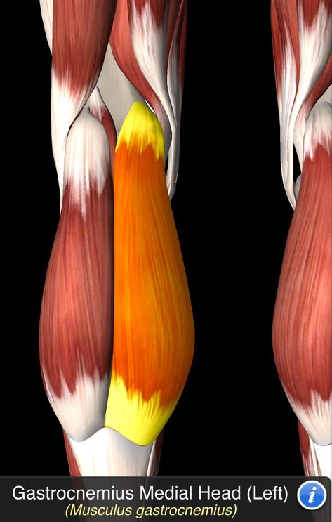 Musculus Gastrocnemius Anatomy Diagrams, Human Muscle Anatomy, Leg Muscle, Human Body Anatomy, Muscle Anatomy, Body Anatomy, Leg Muscles, Anatomy Reference, Foot Pain