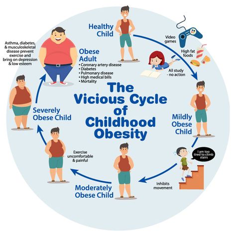 Childhood obesity can include a vicious cycle. Childhood Obesity Facts, Obesity Awareness, Bariatric Surgeon, Childhood Obesity, Video Games For Kids, Stepping Stone, Belly Fat Workout, Delhi Ncr, Exercise For Kids