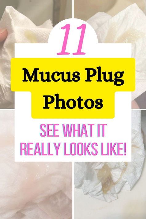 Many first time parents wonder what a mucus plug really looks like during pregnancy and right before labor. If you're a new mom and curious, here are 11 photos of mucus plugs that show different colors, sizes, and shapes. Learn the difference between what a mucus plug and bloody show looks like and how much mucus plug is normal before going into labor and during labor. Click through for all the details and photos! Mucus Plug Signs Labor, Third Trimester Photos, Belly Mapping Pregnancy, Ways To Go Into Labor Faster, Mucus Plug Look Like, Evening Primrose Oil Benefits For Labor, Miles Circuit Labor, Mucus Color Chart, 1st Month Of Pregnancy