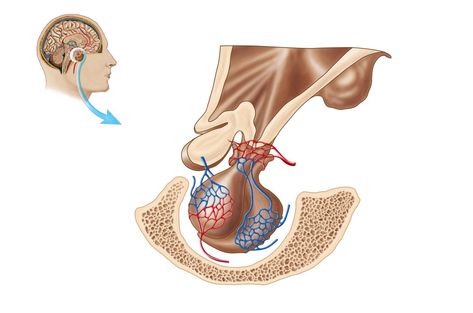 Learn about a rare headache that occurs when a tumor in the pituitary gland starts bleeding, and the possible treatments for this condition. Pituitary Gland Tumor, Pituitary Tumor, Poster Anatomy, Sphenoid Bone, Anterior Pituitary, Spinal Fluid, Basic Anatomy And Physiology, Human Organ, Pituitary Gland