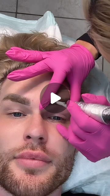 Zach Mesquit on Instagram: "Have you heard of magnetic tattoo removal?! This process was so satisfying. Stay tuned for updates 
#browtattooremoval #tattooremoval #permanentmakeup #pmu" Magnetic Tattoo, Brow Tattoo, So Satisfying, Tattoo Removal, Permanent Makeup, Stay Tuned, Tattoos, Hair, On Instagram