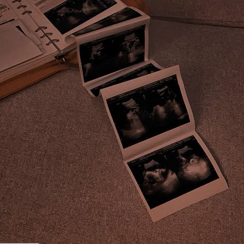 Twins Ultrasound Aesthetic, The Friend Zone Abby Jimenez Aesthetic, Ultrasound Technician Aesthetic Pictures, Ultrasound Nurse Aesthetic, Obgyn Nurse Aesthetic, Ob Aesthetic, Sonography Student Aesthetic, Sonographer Aesthetic, Ultrasound Aesthetic