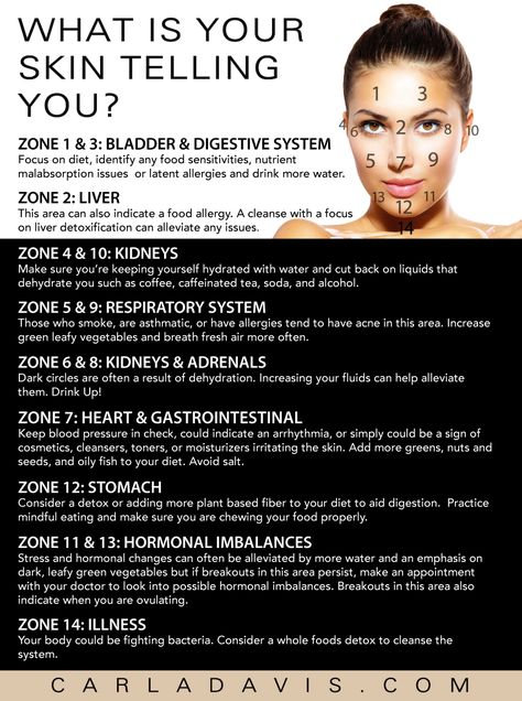 Have you ever noticed how you get blemishes on your chin around that certain time of month? Face mapping is a form of skin analysis that can help us understand the possible causes for these breakouts and do something about it. #skin #beautytip Pimples On Neck, Doterra Acne, Gesicht Mapping, Chin Acne Causes, Cheek Acne, Neck Acne, Chin Acne, Face Mapping Acne, Skin Analysis