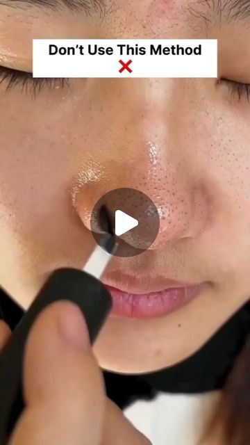 Black And White Heads Removal, Face Blackheads Removal, How To Remove Blackheads From Face, How To Get Blackheads Out Of Nose, How To Get Rid Of Black Heads On Nose, How To Remove Black Heads, How To Get Rid Of Black Heads, White Heads Removal Remedies, Black Heads Removal Homemade