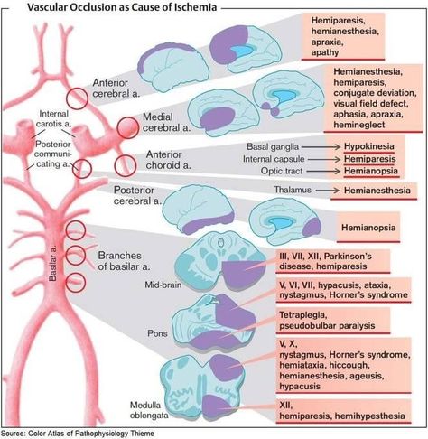 Circle Of Willis, Medical Anatomy, Nursing Tips, The Nervous System, Nursing Education, Medical Knowledge, Speech Language Therapy, Speech Language Pathology, Medical Education