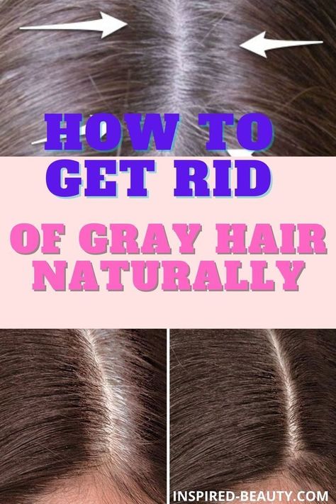 ways to get rid of gray hair at home Grey Hair Home Remedies, Homemade Oils, Remedies For Dry Mouth, Anti Gray Hair, Home Remedies For Allergies, Home Remedies For Warts, Oily Skin Remedy, Gray Hair Color, Natural Remedies For Migraines