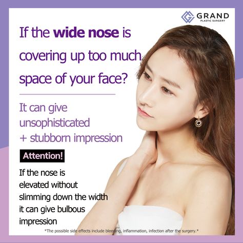 If you have a wide nasal bone just elevating the nose bridge without slimming down the width can make the nose look bulbous and big.  For free consultation Tel: (+82) 70-7119-1580 Mobile: (+82) 10-7156-6546 (Whatsapp, Line, Kakaotalk, Viber, iMessage) Email: grandps.en@gmail.com Facebook: facebook.com/grandplasticsurgery Webstie: eng.grandsurgery.com Pinterest : https://www.pinterest.co.kr/grandps_eng/ Tumblr: http://grandsurgery.tumblr.com Wide Nose, Nose Bridge, How To Slim Down, Free Consultation, Plastic Surgery, Side Effects, Surgery, Bridge, For Free