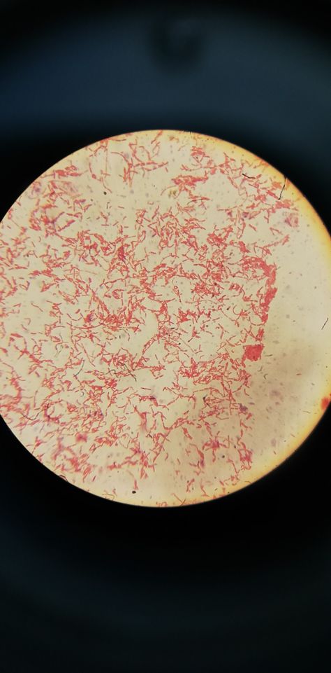 Gram stain / E. coli Gram Staining, E Coli Bacteria, Microbiology, Stain, Red