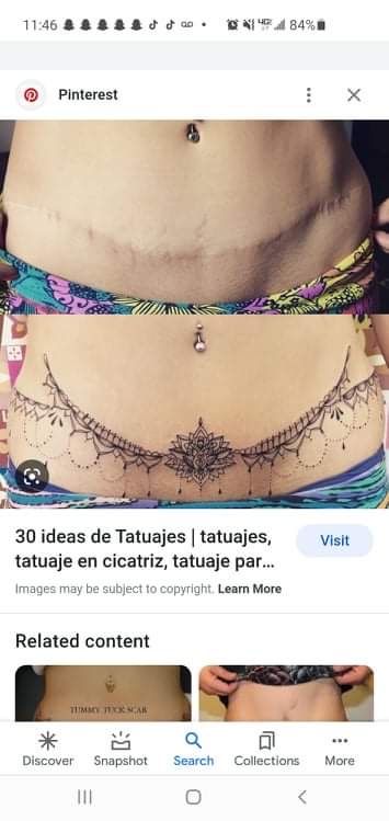 C Section Scar Tattoo, C Section Tattoo, Lower Stomach Tattoos, Tummy Tattoo, Tattoo Over Scar, Vintage Style Tattoos, Scar Cover Up, Chain Tattoo, Tattoos To Cover Scars