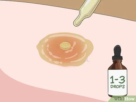 Underarm Boils How To Get Rid, Abcess Remedy For Skin, How To Get Rid Of Boils, Carbuncle Boil Remedies, Skin Boil Remedies, How To Pop A Boil On Your Skin, Diy Boil Remedies, Get Rid Of Boils Fast, Herbs For Boils