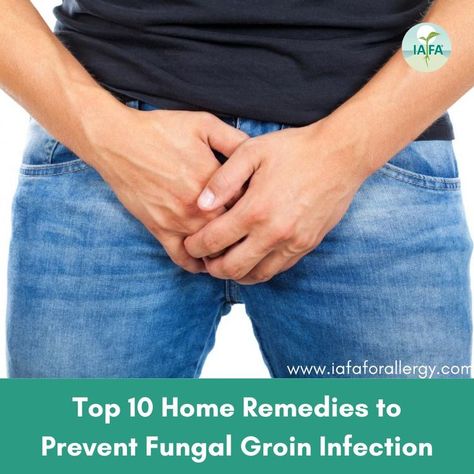 Fungal Groin Infection Groin Rash, Fungal Rash, Fungal Infection Remedies, Types Of Rashes, Yeast Infection Causes, Fungal Infection Skin, Top 10 Home Remedies, Flaking Skin, Infection Prevention