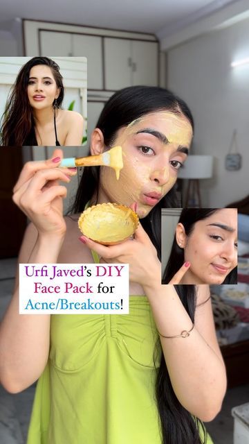 Kareena Tekwani | Beauty Influencer💜 on Instagram: "Urfi Javed’s DIY Face Mask for Acne & Breakouts while getting bright, soft, Glowing Skin 🤌🏻😱❤️

SOO i saw this video long back on Youtube and I definitely wanted to try it out so here you go guys, i tried it out when i was going through major acne & within like 3-4 days my acne completely disappeared & skin definitely felt softer, glowy and WAYY more brighter than it actually was!✅

Ingredients-
1 tbsp Curd
1 tbsp Besan
Pinch of Grated Haldi ( Raw or Whole )
Pinch of Cinnamon (Daal Cheeni)
1/2 a lemon (optional)
1/2 tbsp Honey

P.S. You can use this to treat your body acne as well, but i would suggest noticing if it’s working for your face first & then trying it on your body! Use it on alternate days for best results !✨

Let me know t Besan Face Mask Glowing Skin, Face Mask Glowing Skin, Diy Face Mask For Acne, Face Mask For Acne, Urfi Javed, Mask For Acne, Body Acne, Acne Breakout, Beauty Influencer