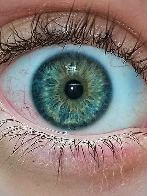 Hetrochormia Eyes Blue And Green, Greenish Blue Eyes, Blue And Green Eyes, Pretty Eyes Color, Limbal Ring, Sky Blue Eyes, Grey's Anatomy Doctors, Taylor Swift Book, Blue Eye Color