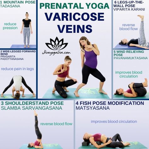 Varicose Veins Exercises, Improve Leg Circulation, Pregnancy Exercises, Leg Circulation, Yoga Steps, Varicose Vein Remedy, Heavy Legs, Fish Pose, Hiit Workout At Home