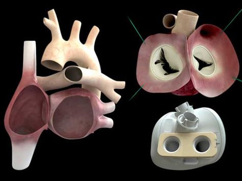 World's First True Artificial Heart Now Beats Inside a 75-Year-Old Patient Artificial Heart, First Time For Everything, Future Trends, Human Art, Fix You, Cool Gadgets, Scientists, First World, Anime Wallpaper