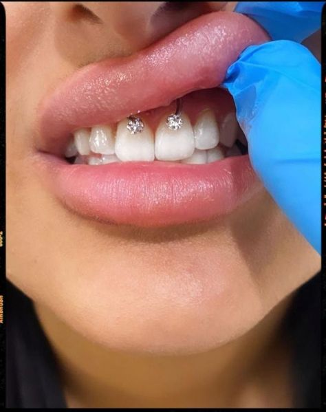 How To Pierce Your Own Smiley, Piecing Ideas Face, Smilie Piercing Aesthetic, Mouth Piercings Smiley, Smiley Piercing Aesthetic, Spectrum Piercing, Cute Facial Piercings, Bijoux Piercing Septum, Dream Piercings