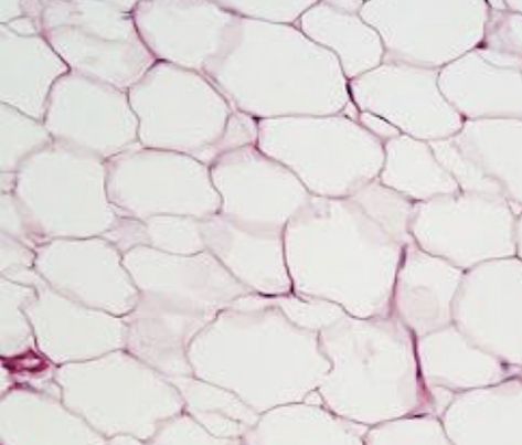 This tissue is made of white and clear cells that store fat droplets, so wherever there is fat there is adipose tissue! This tissue with fat insulates the body and provides cushion and energy. One can identify this tissue by its big white circles that represent the fat cells in the body. An issue with this can become if there becomes too much/big of adipose tissue created because that then would result in obesity. Loose Connective Tissue, Histology Slides, Microscope Parts, Cell Structure, Connective Tissue, Human Anatomy And Physiology, Structure And Function, Adipose Tissue, Body Tissues