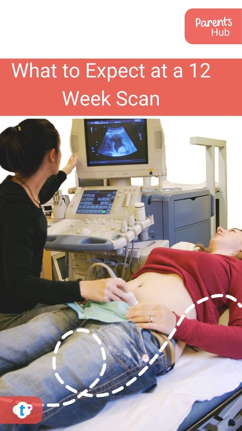 One of the most eagerly anticipated moments is the 12-week scan. In this blog, we'll tell you what to expect from this important appointment, and how to prepare for it. #WhattoExpectata12WeekScan #whatoexpect #twelveweekscan #pregnancy 12 Week Scan, 12 Weeks Pregnant, Pregnancy Week By Week, Baby Birth, 12 Weeks, Thing 1 Thing 2, Parenting, In This Moment