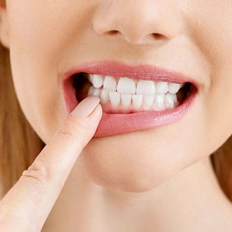 Swollen Gum, Loose Tooth, Tooth Enamel, Tooth Pain, Teeth Health, Stronger Teeth, Periodontal Disease, Receding Gums, Dental Problems