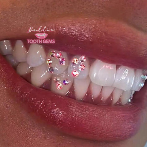 Get gemmed in San Diego! 💎🌊 Tooth Gem Design Ideas, Piercing No Dente, Teeth Jewelry Tooth Gems, Teeth Gems Ideas, Tooth Gem Designs, Tooth Gems Aesthetic, Tooth Gem Placement, Teeth Gems, Pretty Teeth