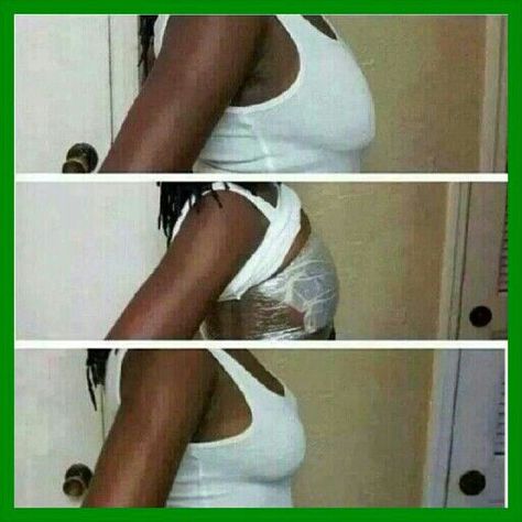 There is no need for expensive breast lifts! Wrap your girls using "my it works" products.   wrapwithfancynancy.myitworks.com Beauty Treatments Spa, Diy Body Wrap, It Works Body Wraps, It Works Wraps, Natural Skin Tightening, Aloe Vera Skin Care, Tighten Loose Skin, Diy Beauty Treatments, It Works Products