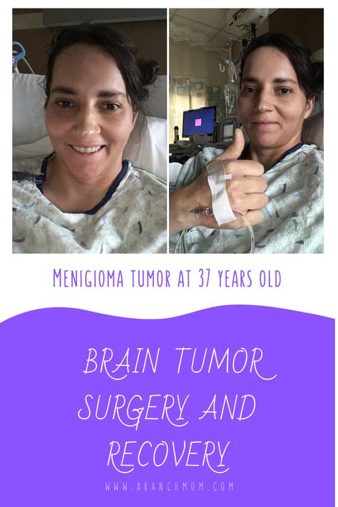 My experience with a brain tumor at age 37. #meningioma #braintumor #brainsurgery Natural Ways To Shrink Tumors, Craniotomy Recovery, Brain Surgery Hairstyles, Brain Surgery Humor, Pituitary Gland Tumor, Brain Surgery Recovery, Surgery Care Package, Brain Tumors, Chemo Hair