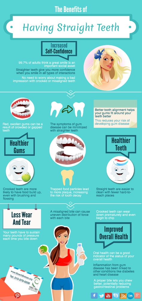 The Benefits of Having Straight Teeth || Beach Braces 1730 Manhattan Beach Blvd. Suite B, Manhattan Beach, CA 90266 TEL: 310-379-0006 Fax: (310) 379-7051 #braces #straightTeeth #orthodontics #dental #oralHealth #BeachBraces #ManhattanBeach Braces Clear, Braces Colors Ideas, Lingual Braces, Braces Cost, Braces Tips, Teeth Alignment, Health Aesthetic, Clear Braces, Bad Teeth