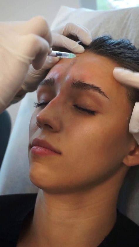 Botox Wrinkles, Aesthetic Dermatology, Facial Fillers, Cosmetic Injectables, Boo Tiful, Injectables Fillers, Facial Aesthetics, Facial Wrinkles, Forehead Wrinkles