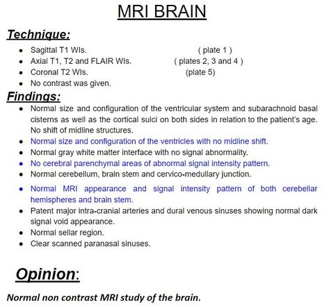 Mri Brain, Rose Template, Medina Mosque, White Matter, Brain Stem, Mri Scan, Medical Anatomy, Entry Hallway, Report Template