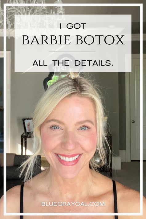 I got trap botox because I have severe shoulder pain and wanted to treat it. Find out how many units of botox for shoulder was used, and learn whether I thought it was painful and if I think the Barbie Botox injection works! Shoulder Botox Before And After, Trap Botox Before And After, How Many Units Of Botox Do I Need, Barbie Botox Before And After, Botox Placement Chart, Botox For Jowls, Botox Mapping, Botox Around Mouth, Masseter Botox Before And After