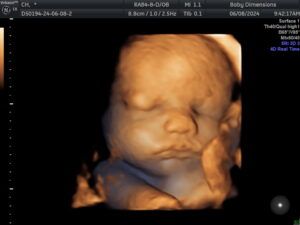 Gallery - Baby Dimensions - 3D Ultrasounds, 4D Live Ultrasounds, and HD Ultrasounds 3d Ultrasound, 4d Ultrasound, Ultrasound, Books, Pins