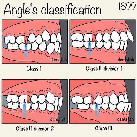 Elevate your dental knowledge with our engaging multiple-choice quiz designed to challenge even the most seasoned professionals. Dive into a vast array of topics that will test your understanding and sharpen your skills. Whether you���������re a student eager to learn or a practitioner looking to refresh your expertise, this quiz offers a fun and interactive way to enhance your p Dental Assistant Study Guide, Fake Braces, Dental Assistant School, Dental Hygienist School, Dental Wallpaper, Dental Assistant Study, Dental Hygiene Student, Dental World, Dental Hygiene School