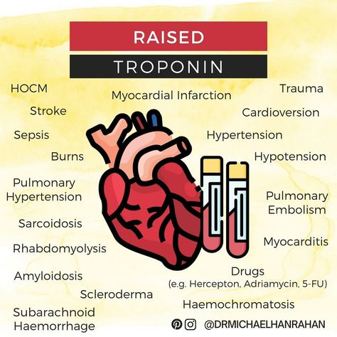 Troponin Levels, Electrophysiology Of The Heart, Blood Flow Through The Heart Mnemonic, Heart Transplantation, Left Ventricular Failure, Heart Valves Disease, Subarachnoid Hemorrhage, Medical Pins, Medical Education