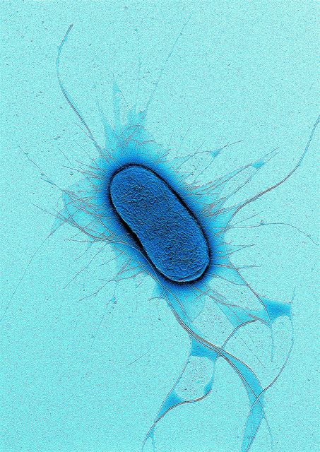 E. coli negatively stained with 1% Uranyl acetate. Microscopic image Coagulation Factors, Food Contamination, Macro Fotografie, Microscopic Organisms, Micro Photography, Microscopic Images, Medical Laboratory Science, Electron Microscope, Food Poisoning