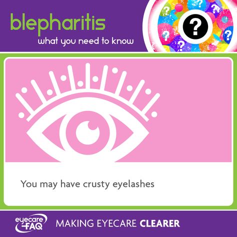 You may have crusty eyelashes and/or swollen lid margins. Some people can find it affects the growth of eyelashes. Crusty Eyelashes, Lazy Eye, Eye Care, Some People, Find It, Eyelashes, Need To Know