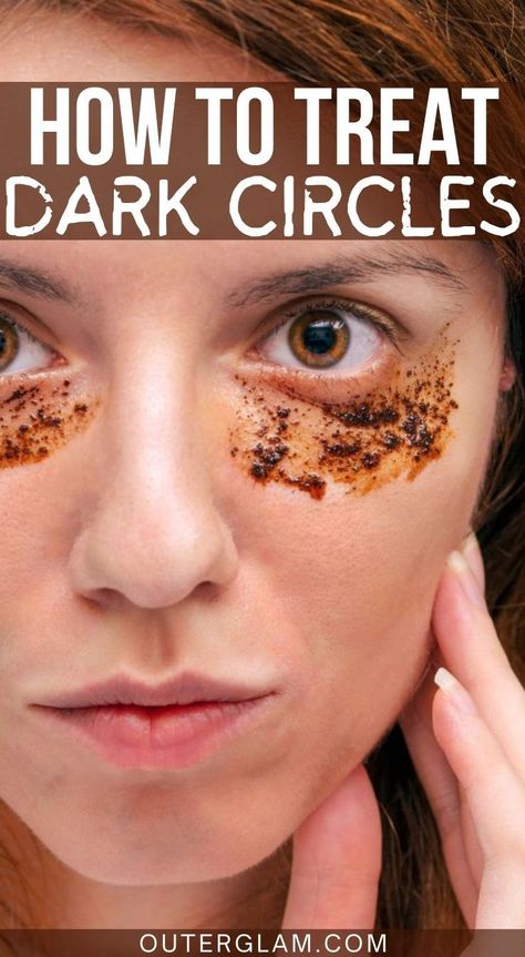 Whether you've battled with pesky dark circles for years or you've just noticed them creeping in, dealing with them can be a real challenge. If you're searching for effective solutions to banish those under-eye shadows and regain a fresh look, this article is for you. Dive into a comprehensive guide covering the causes of dark circles and a range of remedies to help you achieve brighter, healthier skin. Homemade Remedies For Dark Circles, Dark Eye Circles Remedies, How To Get Rid Of Dark Circles Under The Eyes, Black Circles Under Eyes Remedies, Dark Circles Natural Remedy, Dark Puffy Circles Under Eyes, Dark Circles Under The Eyes Remedies Natural Treatments, Dark Eye Circles How To Get Rid Of, How To Get Rid Of Dark Circles Under Eye Naturally