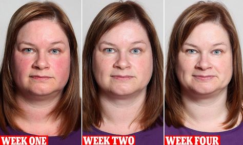 WOW! We knew that alcohol can be damaging to your skin - causing redness, dryness, flushing - but check out Laura's before and after shots when she gave up drinking for a month. Giving Up Drinking, Giving Up Alcohol, Quit Drinking, Drinking Alcohol, Chubby Cheeks, Bad Food, Digestive System, Damaged Skin, Weight Gain