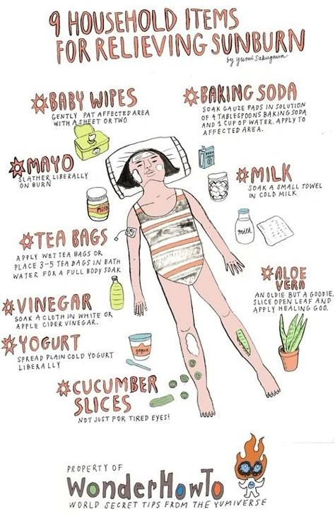 Sunburn Remedies, Sunburn Relief, Body Hacks, Holistic Approach, Health Remedies, Household Hacks, Household Items, Home Remedies, Natural Remedies