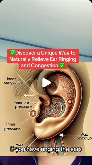 Raw (Mourab) Maraby on Instagram: "✅ Discover a Unique Way to Naturally Relieve Ear Ringing and Congestion ✅
#Mucus 
#Blockedears
	1.	#earhealth 
	3.	#tinnitusrelief 
	4.	#ringingintheears 
	6.	#earpressure" Ear Congestion, Blocked Ears, Ear Ringing, Ear Pressure, Ear Health, Inner Ear, 3 Ingredient, How To Make Your, Make Your