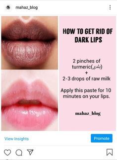 How To Lighten Dark Lips Naturally, Tips For Dark Lips, Lip Mask For Dark Lips, Lip Mask Homemade For Dark Lips, Lip Care For Dark Lips, Dark Lips Remedy Homemade, How To Lighten Lips, How To Lighten Dark Lips, Skin Pigmentation Remedies