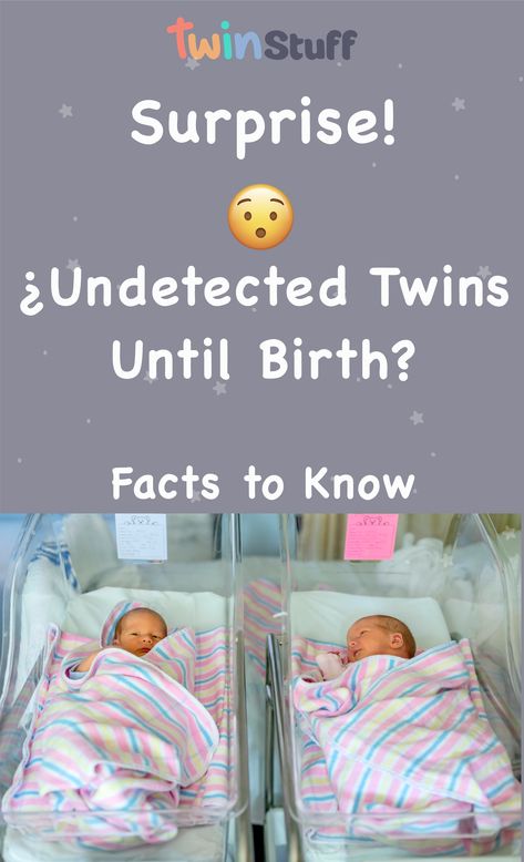 The ultrasounds, doctor appointments, signs, and symptoms; nothing showed up until it was time to deliver your precious baby. When, suddenly, your doctor tells you there is one more baby that has been hiding, giving you undetected twins until birth. How can this happen? Do other expectant moms and dads encounter similar surprises? Hidden Twin Ultrasound, Twin Homebirth, Twin Ultrasound, Twins Ultrasound, Birth Facts, Useful Facts, Conjoined Twins, Doctor Appointment, Twin Mom