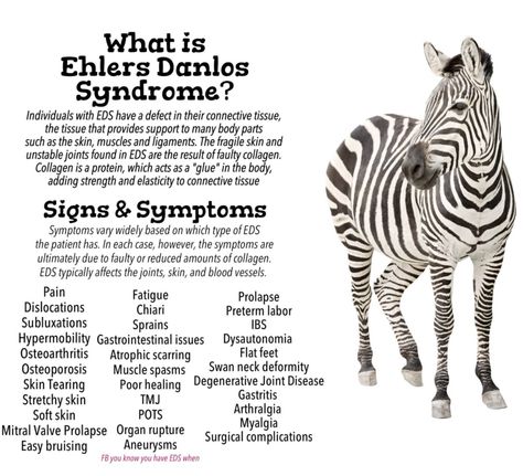 Ehlers danlos syndrome symptoms. It's EDS awareness month. Please share this. Vascular Ehlers Danlos Syndrome, Ehlers Danlos Syndrome Types, Ehlers Danlos Syndrome Symptoms, Elhers Danlos Syndrome, Ehlers Danlos Syndrome Hypermobility, Ehlers Danlos Syndrome Awareness, Party Tricks, Rare Disorders, Chiari Malformation