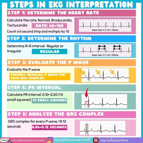 Nurse Vicky | RN, MN, PhDN(c) on Instagram: “Steps in EKG interpretation! Save this post❤️ . . . #nclexpn #nclexrn #nclexstudying #nclexprep #nclexreview #nclextips #nclexhelp…” Ekg Interpretation Made Easy, King Abdulaziz, Ekg Interpretation, Ecg Interpretation, Pr Interval, Nclex Prep, Nursing School Essential, Nurse Study Notes, Nursing Student Tips