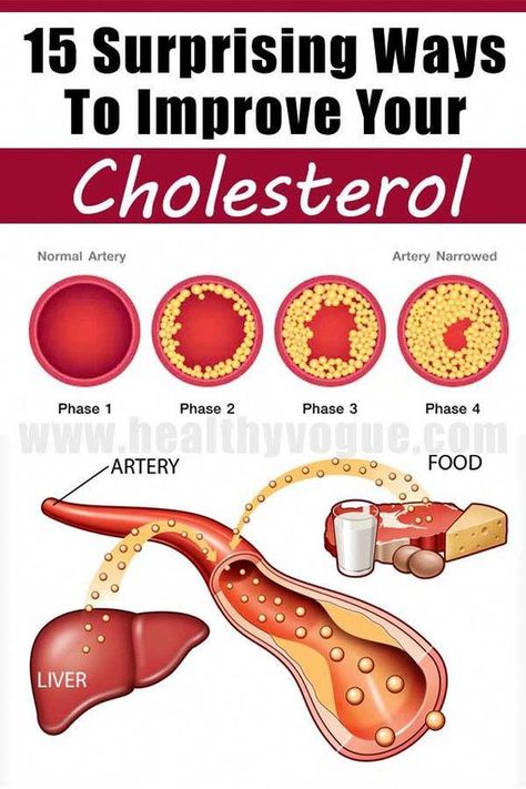 Ways To Lower Cholesterol, To Lower Cholesterol, Bad Cholesterol, Lower Your Cholesterol, Cholesterol Diet, Healthy Diet Tips, Low Cholesterol, Daily Health Tips, Fitness Advice